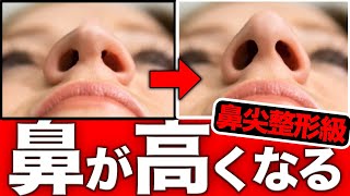 [Nose tip plastic surgery grade] How to make your nose absolutely tall!