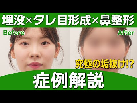 【症例公開】お悩み箇所だけを改善するだけでこんなにも変われる