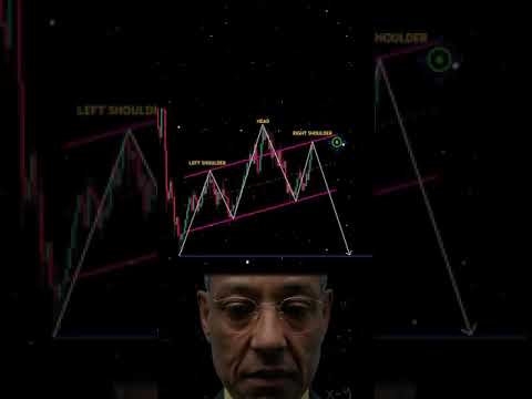 How Trading Works Head & Shoulders Pattern | Head & Shoulders Patterns #trading #tradingpatterns