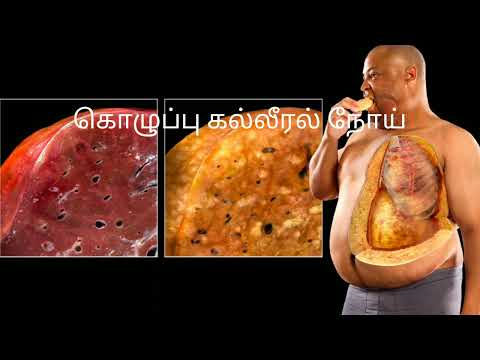 liver issues symptoms tamil/liver is not working properly symptoms tamil/liver problems tamil