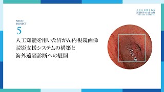 胃がんをAIで早期発見！ 内視鏡医療の精度向上・均てん化へ