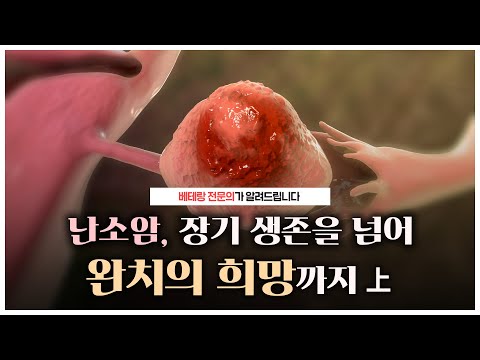 난소암, 장기 생존을 넘어 완치의 희망까지 -上-