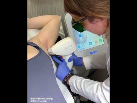 Laser Hair Removal I Gendler Dermatology