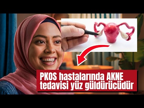 Polikistik Over Sendromunun Bilinmeyenleri! Akne ve Kıllanmaya Çözüm.