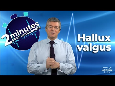 L'hallus valgus - 2 minutes pour comprendre