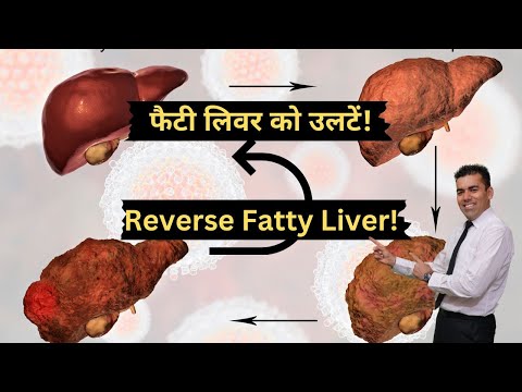 बचा लो, बचा लो Save your liver! Do these steps to save your liver! Follow our program to understand!