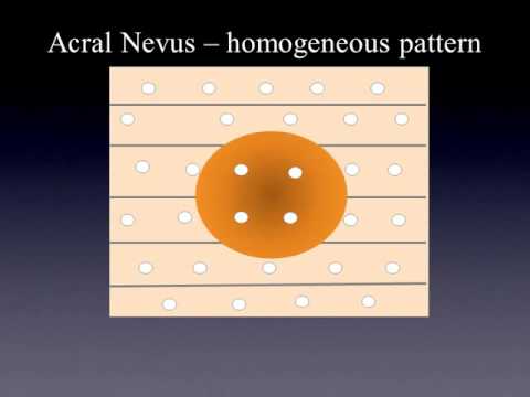 Anatomy of the acral skin by Dr. Rainer Hofmann-Wellenhof