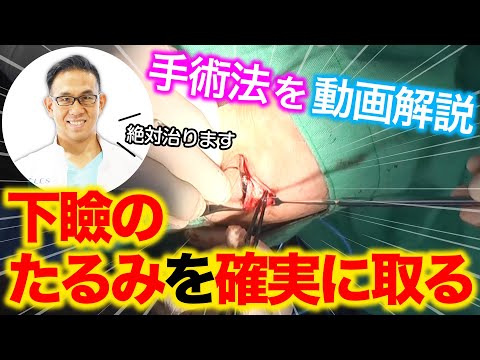 【美容整形】下まぶたのたるみ取り手術はお得!!