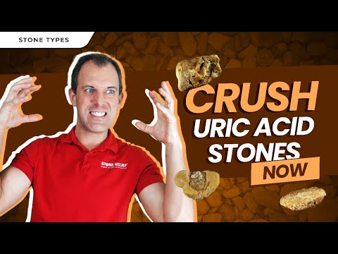 Uric Acid Stone SUBTYPES Explained