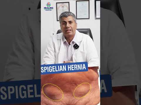 Common Types of Hernia And Its Types #hernia #herniatreatment