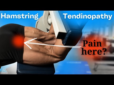 Proximal Hamstring Tendon Rehab: Progression Exercises for Buttock Pain!