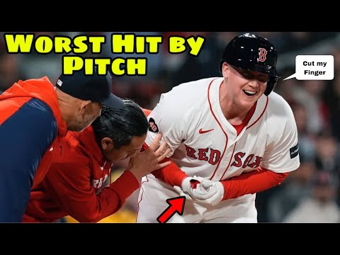 MLB | Hit By Pitch April 2024 part 2