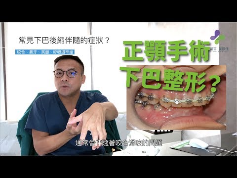 請問一下謝明吉醫師-我到底該做正顎手術還是下巴整形？