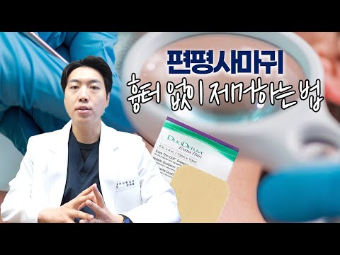 편평 사마귀 제거와 관리법, 흉터 없이 완벽하게 관리하는 법