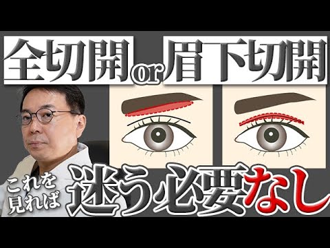 全切開？眉下切開？どちらが適応なのか迷ってる方へ！まずは〇〇すべし！