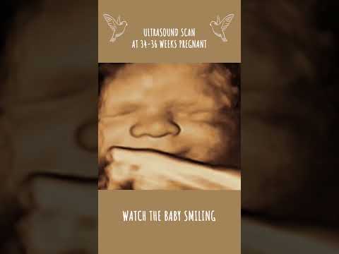 Third Trimester Ultrasound: Watch the Baby Smiling #pregnancy #baby #love