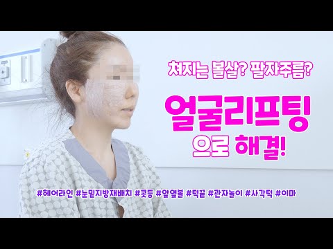 동안으로 보이는 마법? 얼굴리프팅