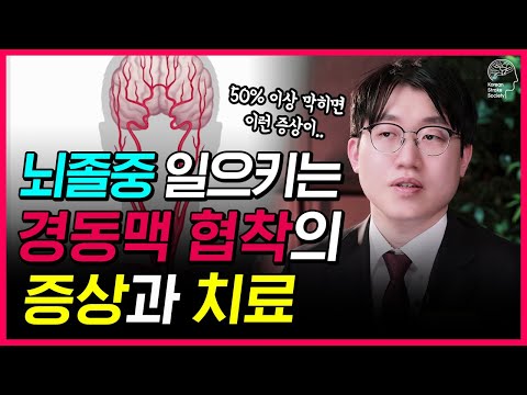 좁아지고 딱딱해지는 경동맥 협착! ㅣ뇌졸중 막기 위한 예방과 치료법