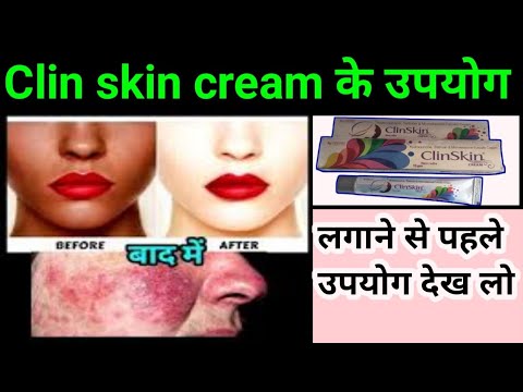 Clin skin cream के क्या क्या उपयोग है l What are the benefits of Clin skin cream? #CNGAJBHIYE