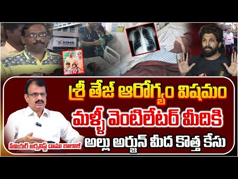 శ్రీ తేజ్ ఆరోగ్యం విషమం..!?Another Case Filed On Allu Arjun | Revathi Son Sri Tej Health Condition??