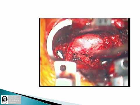 AANS Coding Shorts: Introduction of the 63052 and 63053