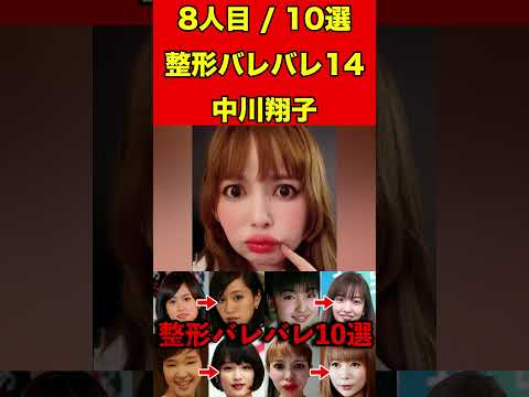 中川翔子14整形がバレバレな芸能人！10選 #芸能界の闇 #ゴシップ #整形 #芸能人 #噂話 #有名人  #雑学 #モデル #芸能 #女優 #アイドル #美容