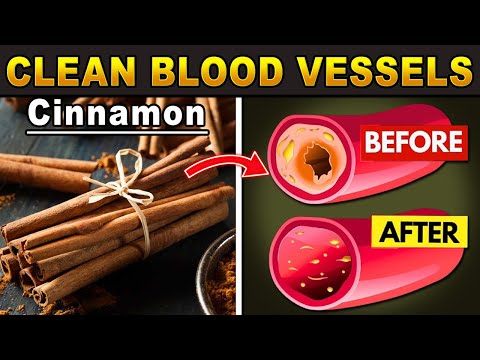 ✅ This is the BEST HERBS to clean your blood vessels! 🩸 -  Healthy lifestyle