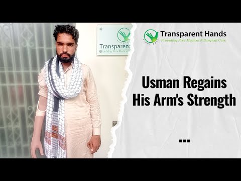 Usman Ali’s Arm Shape was Restored