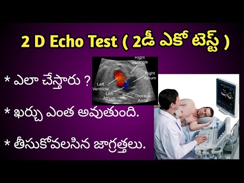 2D-Echo Heart Test procedure in Telugu ( 2 డీ ఎకో టెస్ట్ ఎలా చేస్తారు )