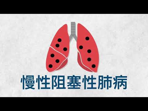 【醫生話你知】認識肺病防患未然︱家庭醫生帶你認識三種肺病成因及預防方法 #UCN #社康 #健康 #肺部 #肺癌 #肺炎 #慢性阻塞性肺病