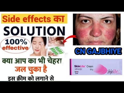 skin lite Cream | skin lite cream के साइड इफेक्ट कैसे ठीक करे | cream के side effect solutions