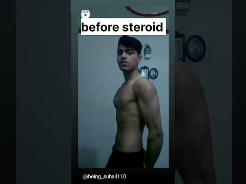 befor steroid and after#trending #viral