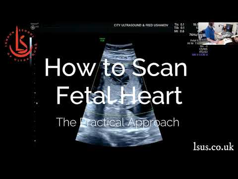 Fetal Heart Online Masterclass - 3 July 2021