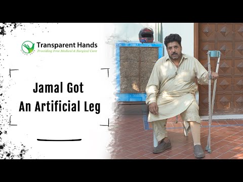 Syed Jamal Overjoyed to Get an Artificial Leg