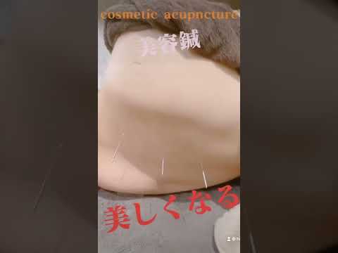 【美容鍼】美しくなる鍼灸治療#美容鍼 #鍼灸治療 #恵比寿