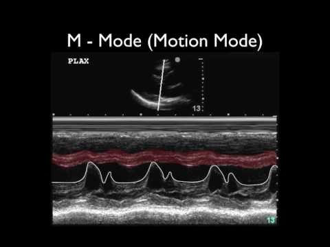 Ultrasound Physics Scanning Modes M Mode