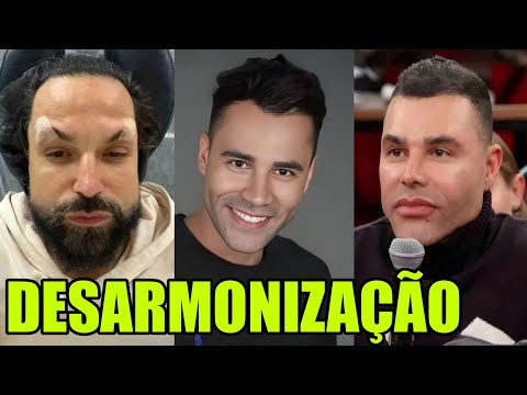 13 FAMOSOS que PIORARAM após HARMONIZAÇÃO FACIAL e VOLTARAM ATRÁS