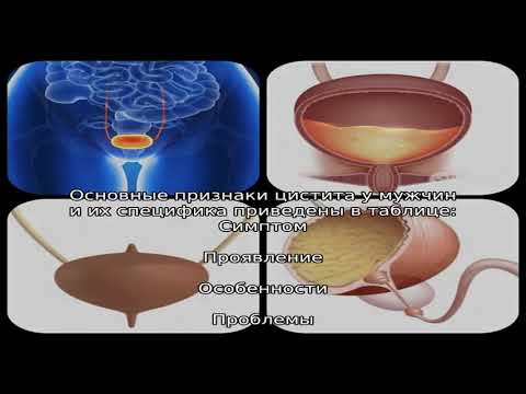 Развитие цистита у мужчин: симптомы, причины, методы лечения