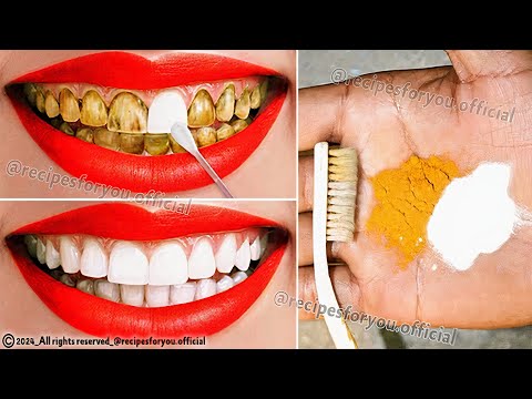 Natural mixtures for yellow teeth whitening at home in 2 minutes without a dentist, a proven method💯