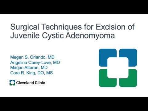 Surgical techniques for excision of juvenile cystic adenomyoma