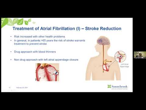 Dr Sheldon Singh Atrial Fibrillation Explained