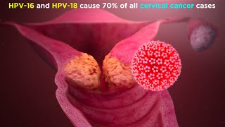 Human Papillomavirus (HPV)