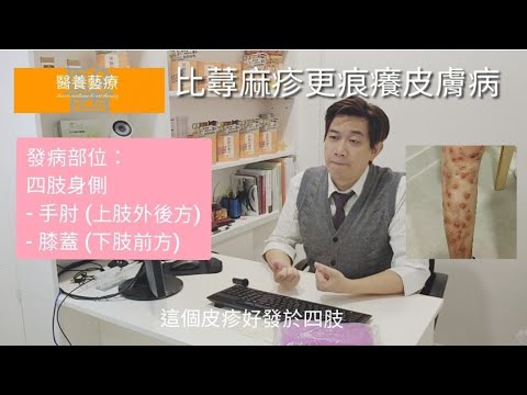 最痕癢皮膚病是甚麼?