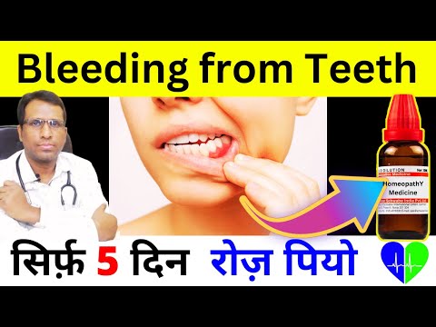 Managing Gum Bleeding  Effective Ways to Stop Bleeding from Teeth