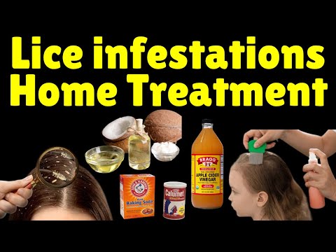 Lice Infestations Home Treatment | Home Remedies for Lice | How to Get Rid of Lice at Home