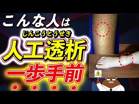 【危険】腎臓からの超意外なSOSを絶対見逃さないで！目、皮ふ、足..透析寸前のサインとは。「尿毒症」とは何か？腎臓病の予防法とは？医師が徹底解説！