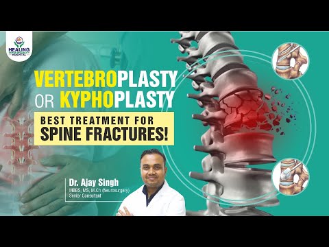 Spine Fracture का Kyphoplasty/Vertebroplasty से इलाज | Spine Fracture Surgery | Healing Hospital