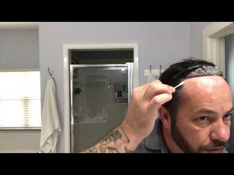 Scalp Protector Install For Your Hair Replacement Or Hair System | It Could Make It Good Or Bad