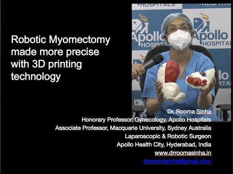 Robotic Myomectomy made more precise with 3D printing technology Dr Rooma Sinha Apollo Hospitals