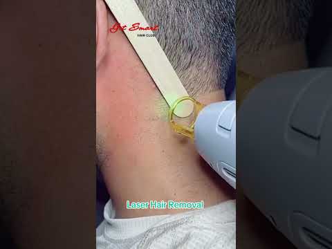 Laser Hair Removal #getsmarthairclub #beauty #viralvideo